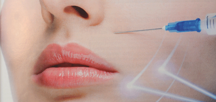 υαλουρονικό οξύ